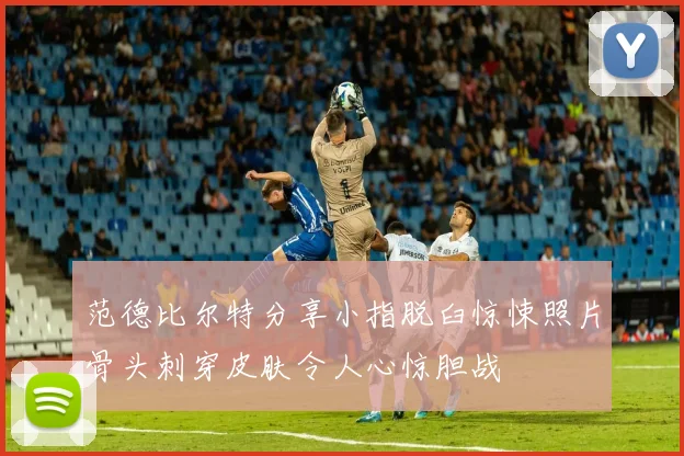 范德比尔特分享小指脱臼惊悚照片骨头刺穿皮肤令人心惊胆战